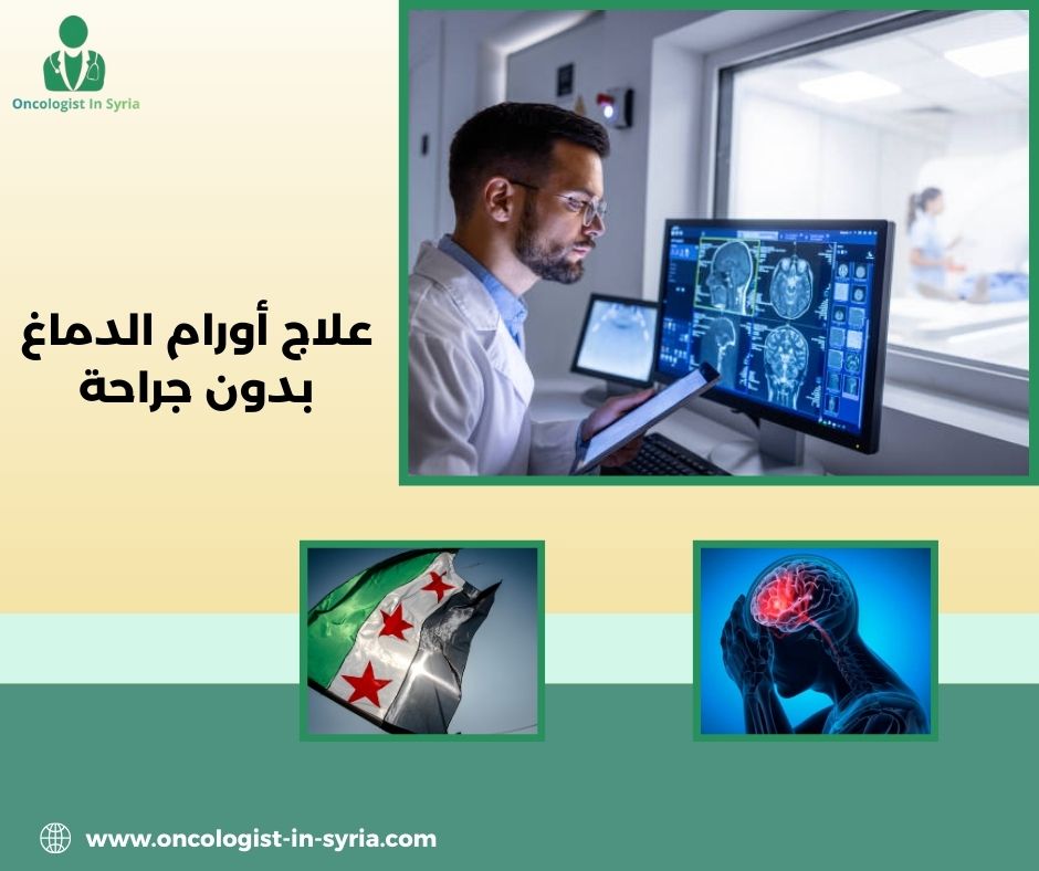 كم يعيش مريض ورم الدماغ الحميد