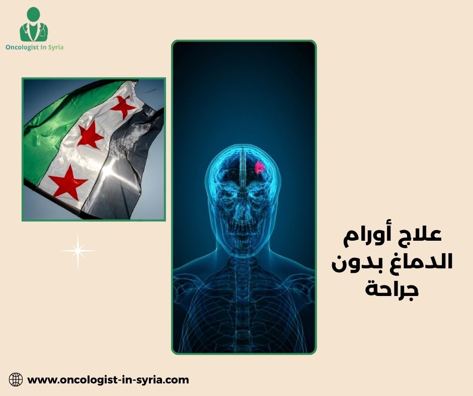 علاج ورم المخ الخبيث