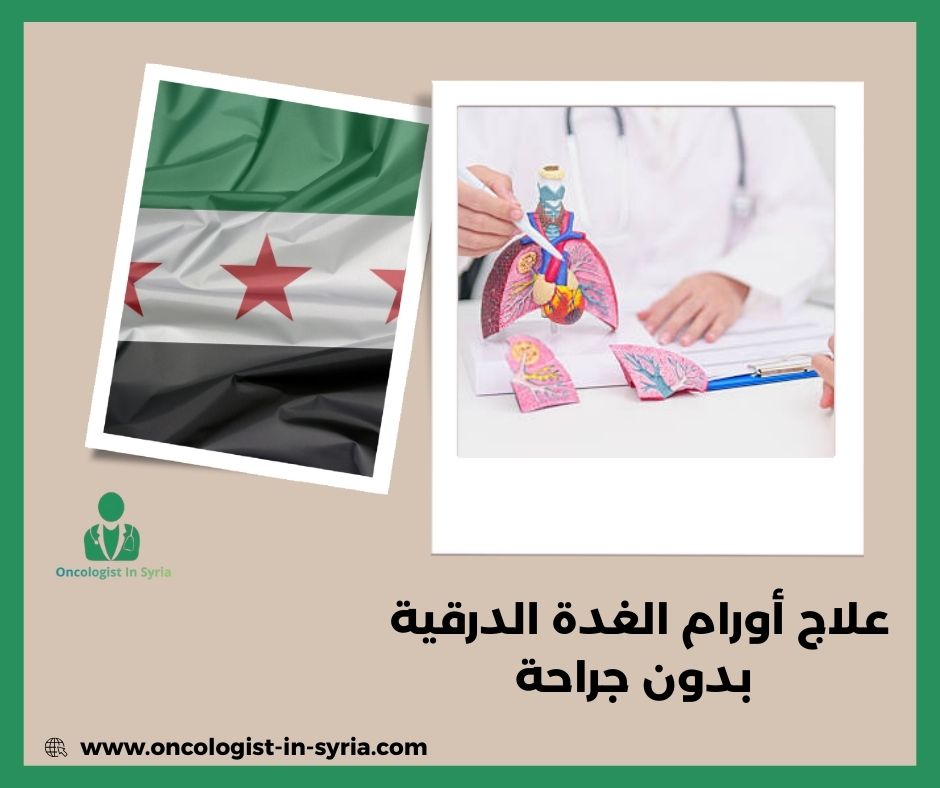 تجربتي مع عقد الغدة الدرقية