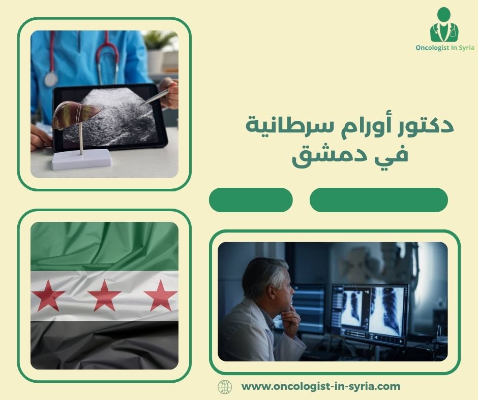 دكتور أورام سرطانية في دمشق