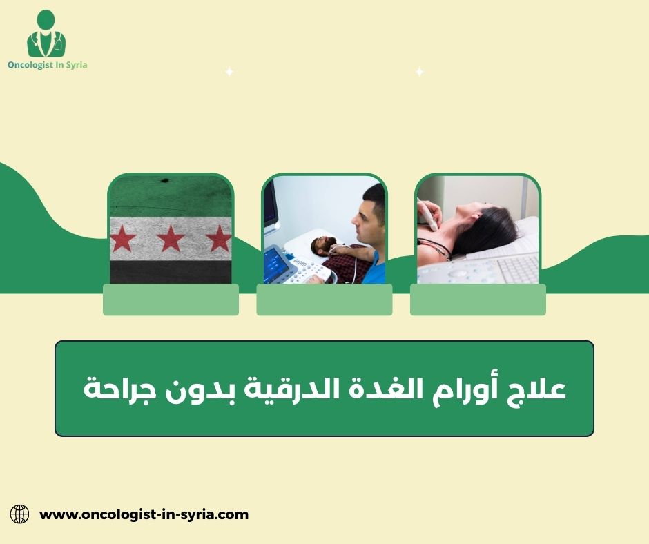 علاج أورام الغدة الدرقية بدون جراحة