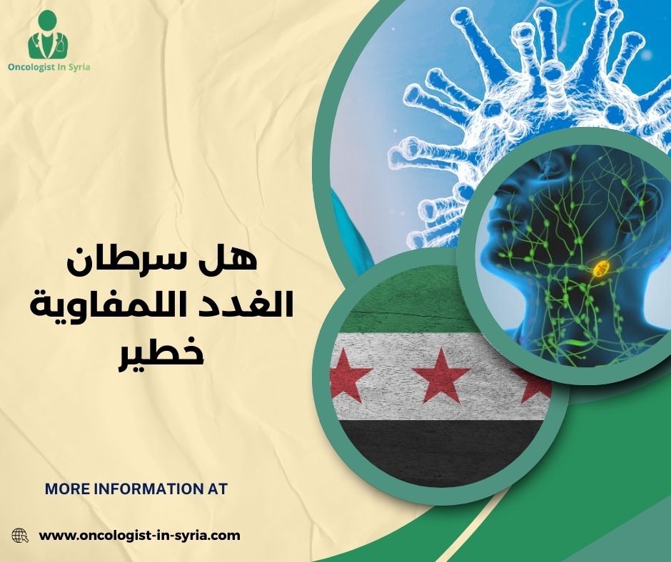 هل سرطان الغدد اللمفاوية خطير