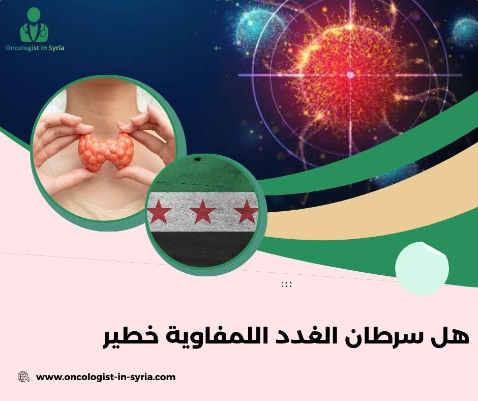 هل سرطان الغدد اللمفاوية خطير