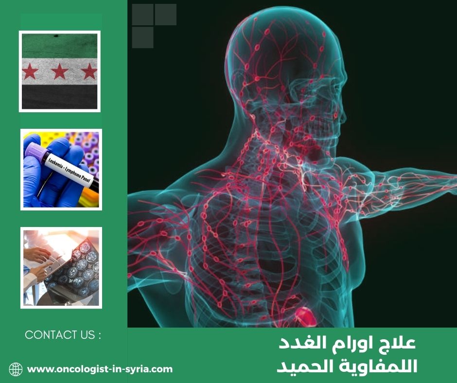 علاج أورام الغدة الكظرية