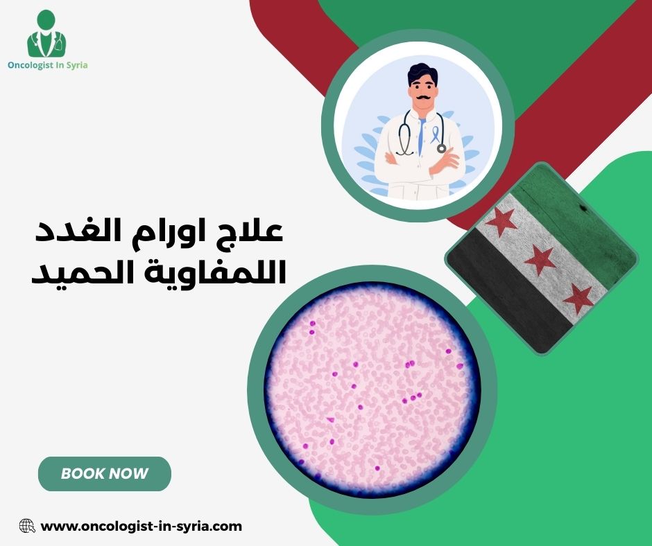 علاج أورام الغدد اللعابية