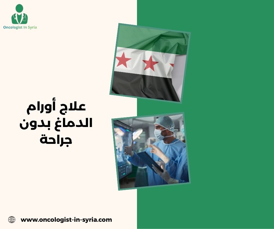 هل يمكن علاج أورام الدماغ بدون جراحة؟