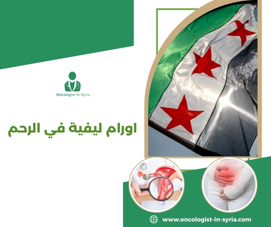 اورام ليفية في الرحم