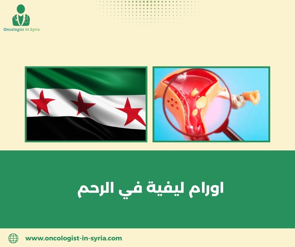 اورام القولون