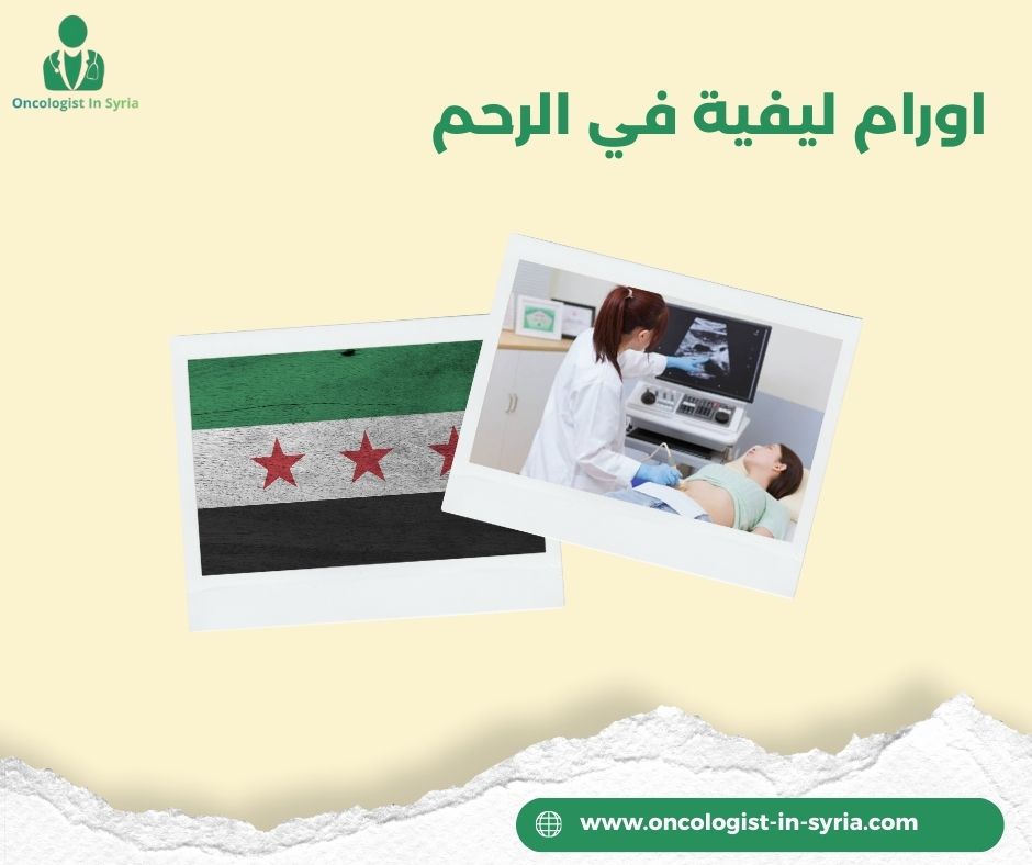 اورام ليفية في الرحم