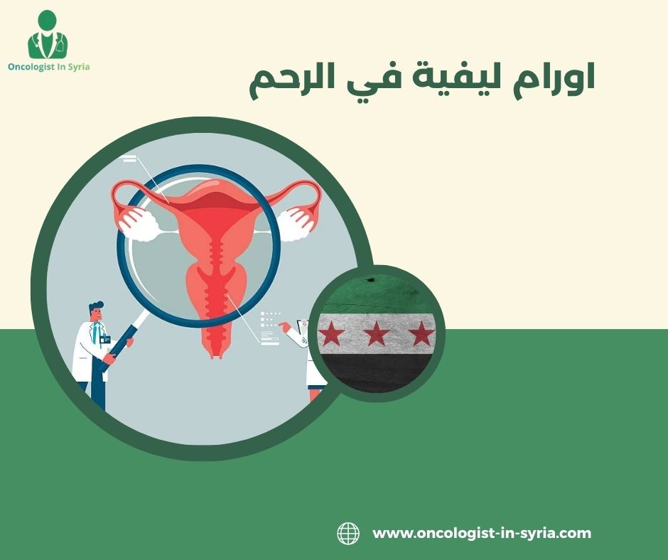 هل يمكن أن تعود الأورام الليفية للظهور مرة أخرى بعد علاجها؟