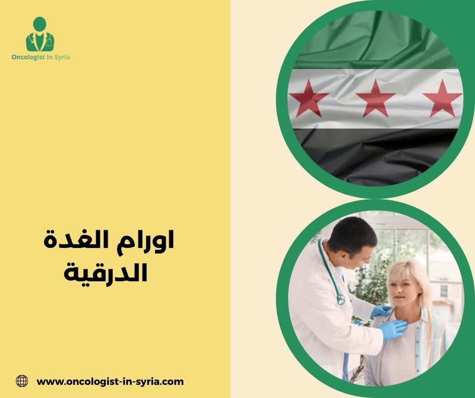 اورام الغدة الدرقية