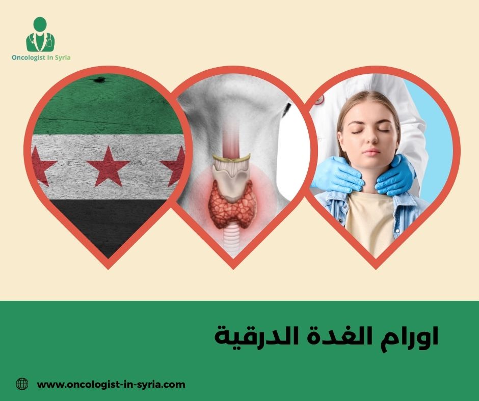 اورام الغدة الدرقية