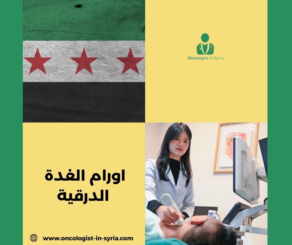 اورام الغدة الدرقية