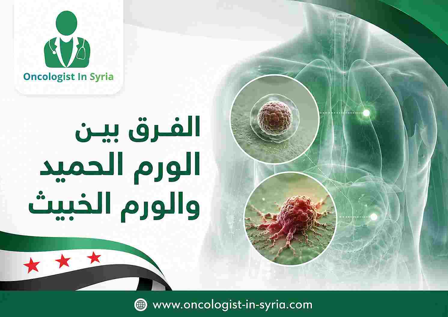 الفرق بين الورم الحميد والورم الخبيث