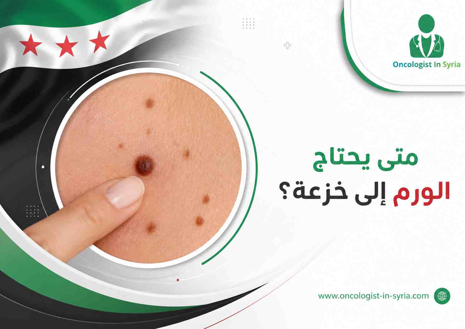 متى يحتاج الورم إلى خزعة؟
