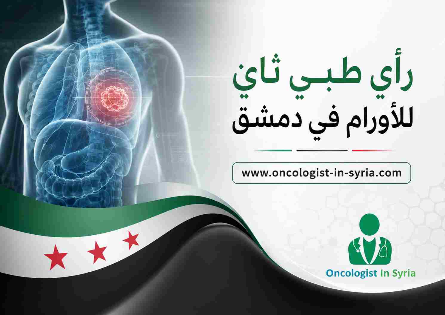 رأي طبي ثانٍ للأورام في دمشق