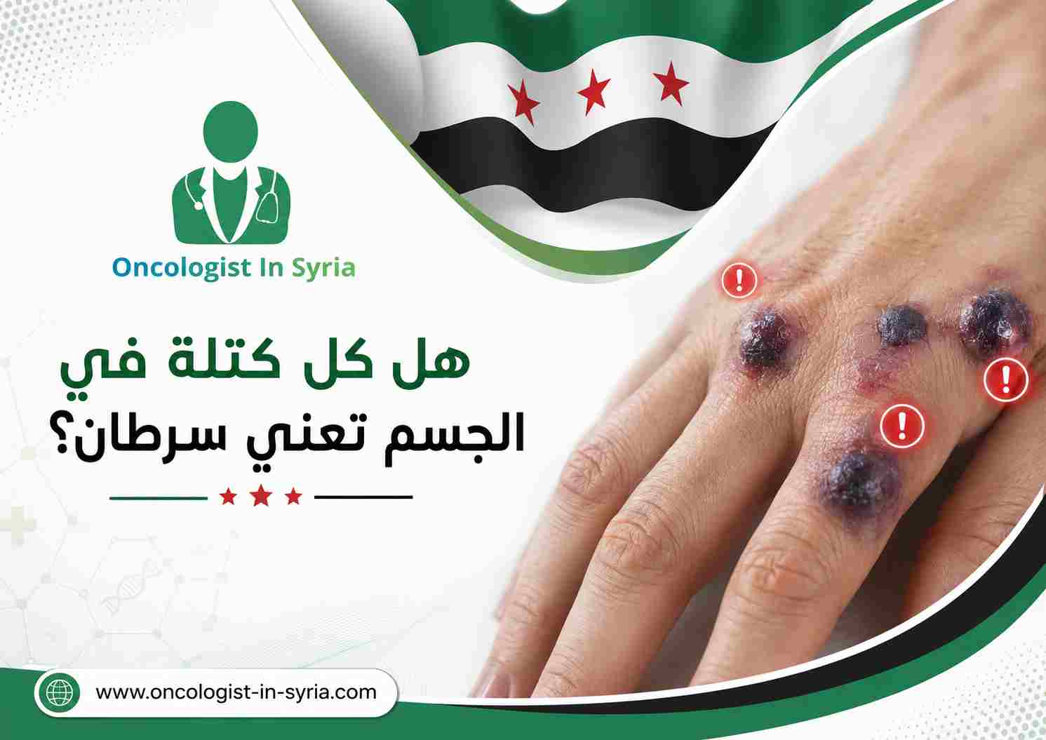 هل كل كتلة في الجسم تعني سرطان؟