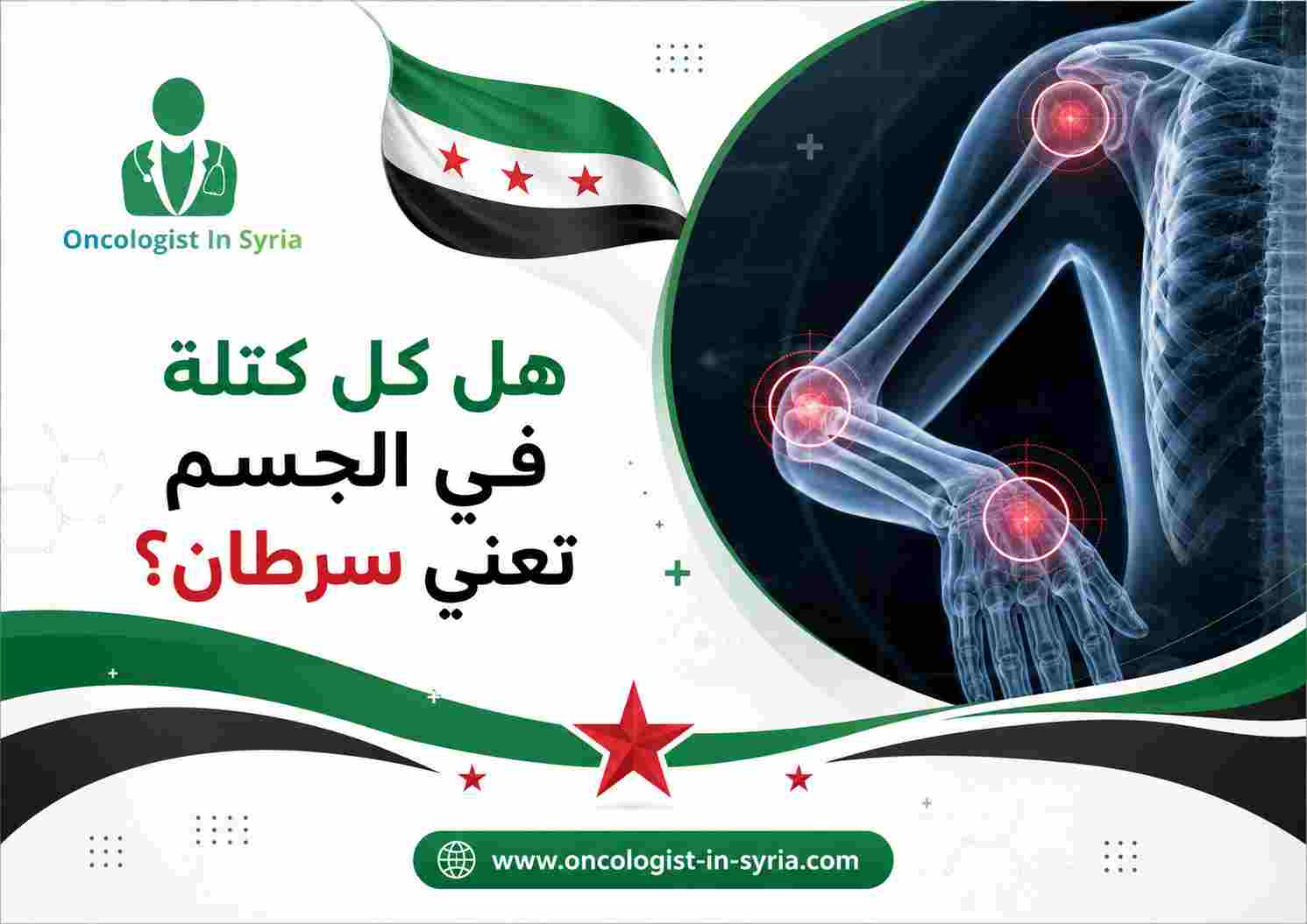 هل كل كتلة في الجسم تعني سرطان؟