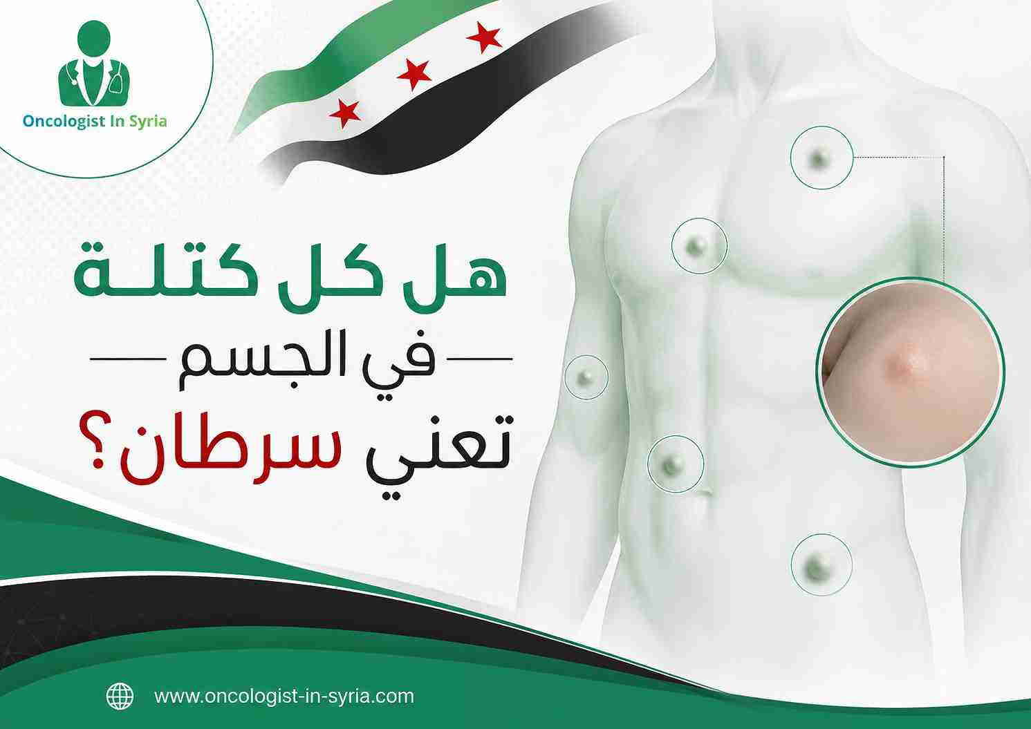 هل كل كتلة في الجسم تعني سرطان؟