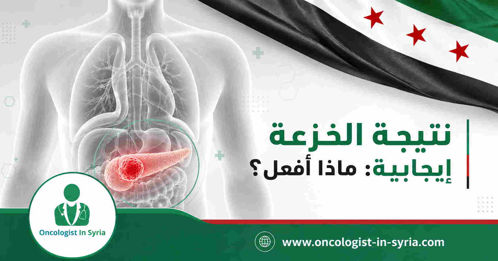 نتيجة الخزعة إيجابية: ماذا أفعل؟