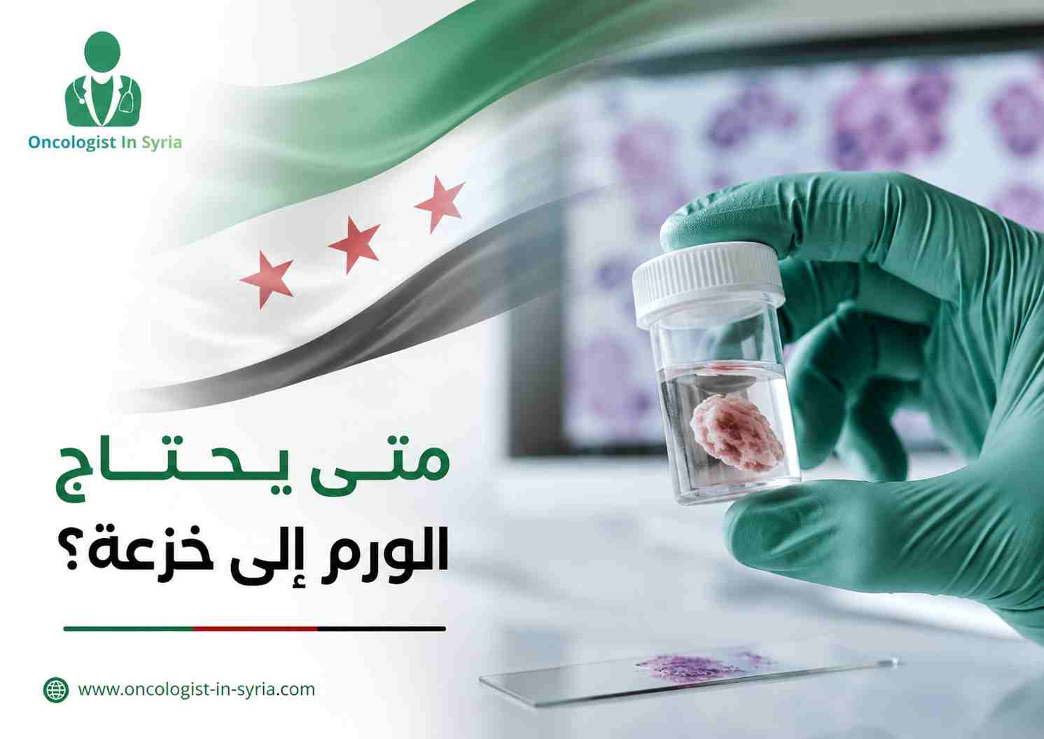 متى يحتاج الورم إلى خزعة؟